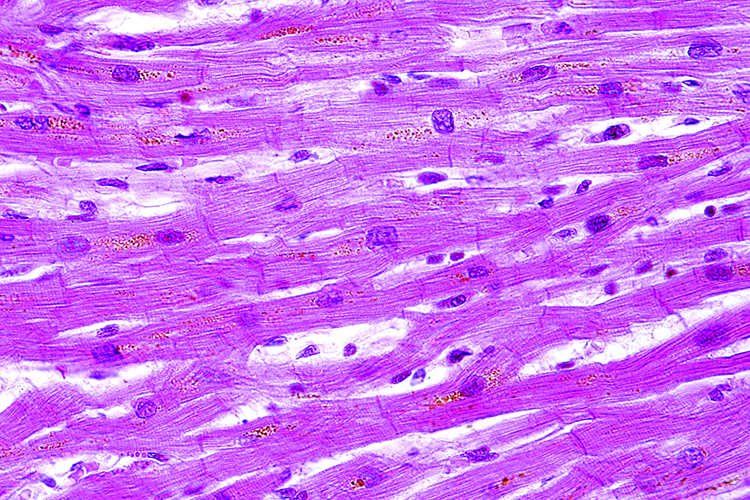 Human pluripotent stem cell-derived cardiomyocytes in drug discovery ...