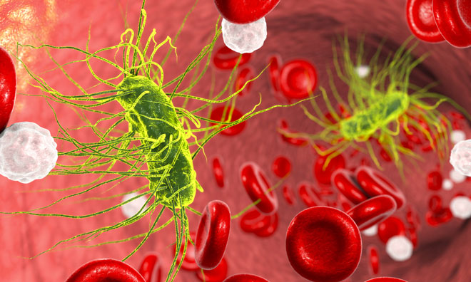 Quick test finds signs of sepsis in a single drop of blood