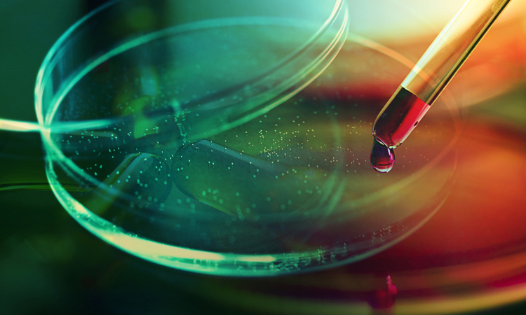 CLD cell line development