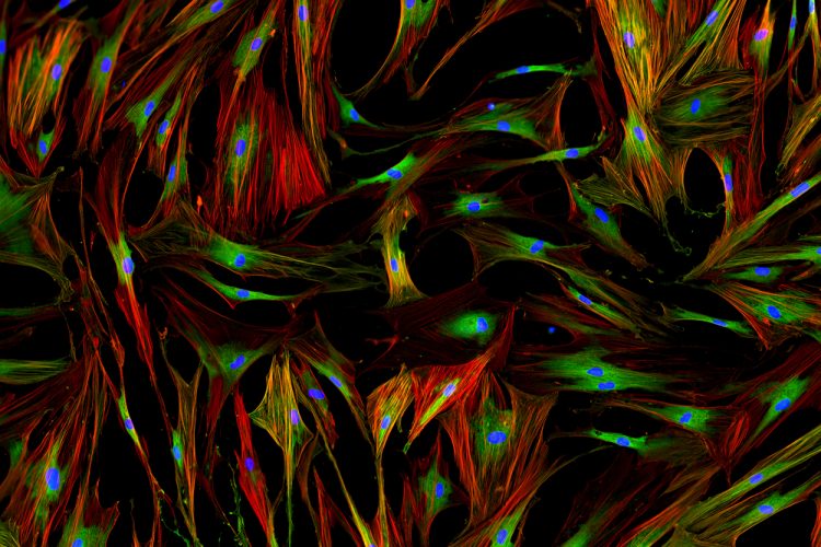 Stimulating Fibroblasts Can Trigger Hair Growth In Wound Healing